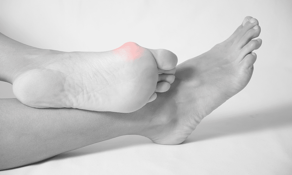 Happy Feet: The Top Signs You Need Bunion Surgery