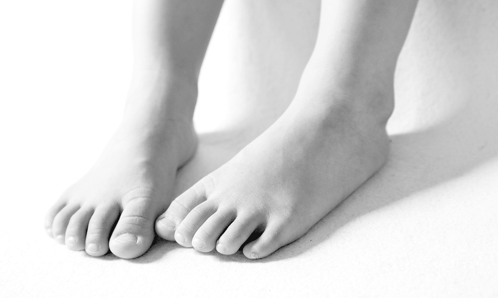 How to Tell If You Have Flat Feet