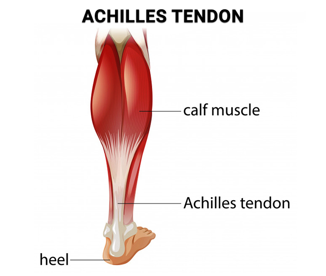 Achilles Tendon