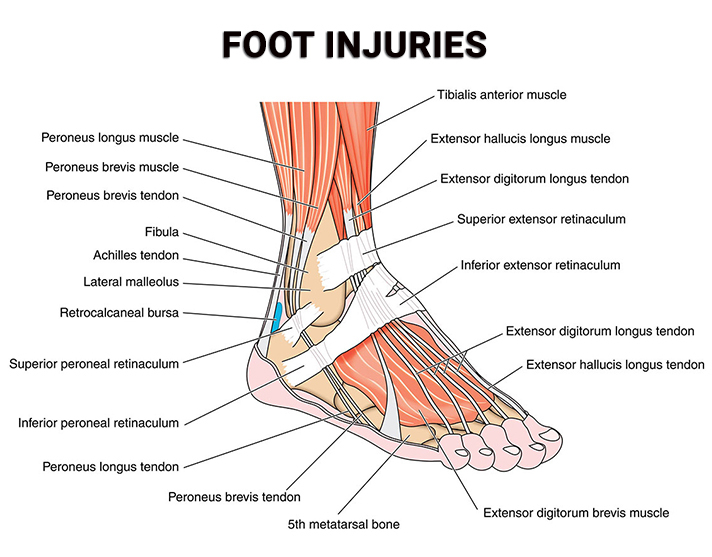 Foot Injuries NJ
