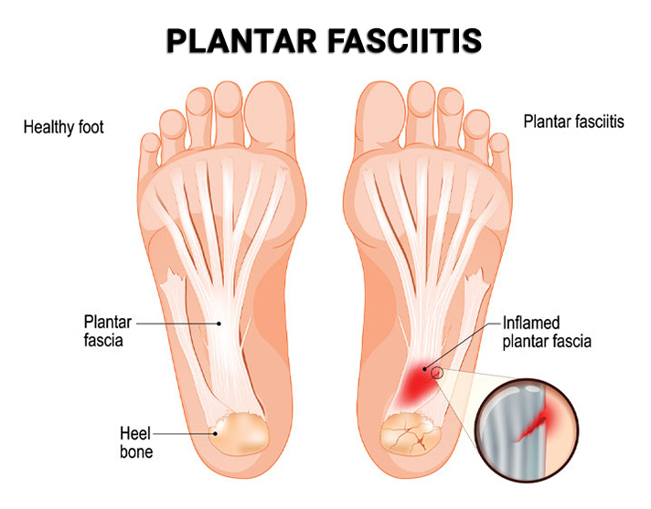 Foot Pain Doctor NJ