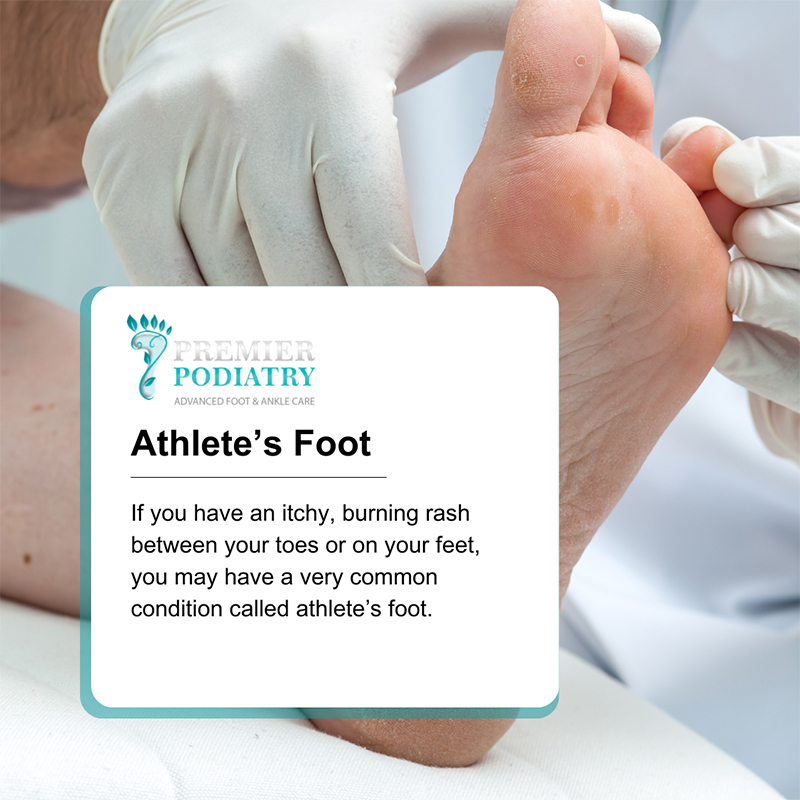 Athletes Foot in NJ