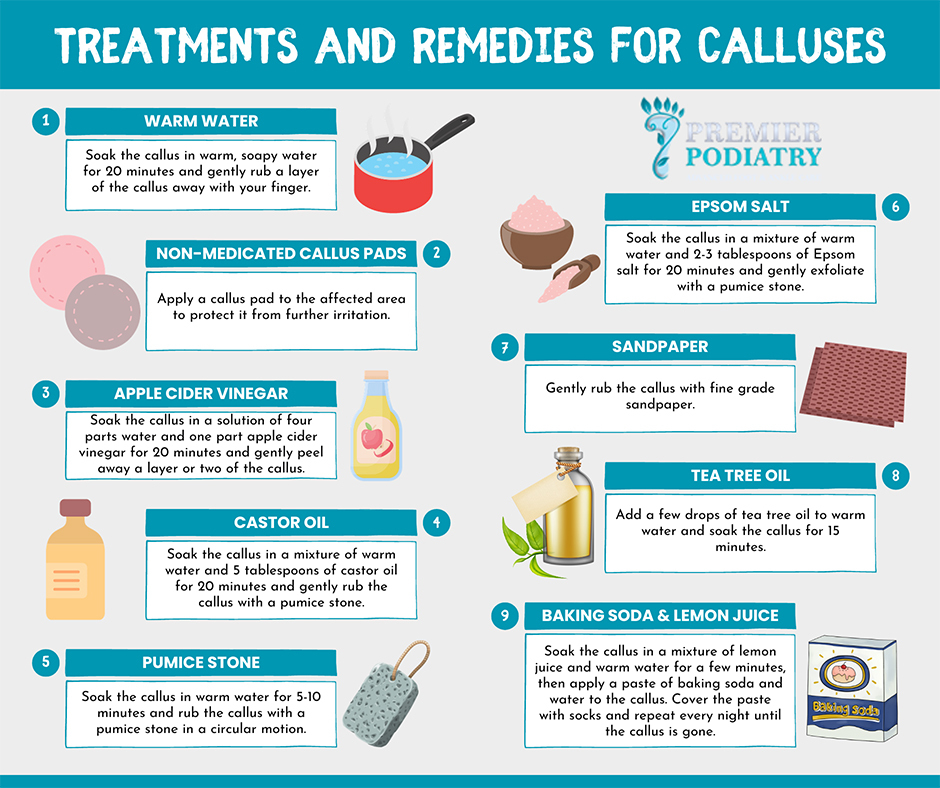 How to Get Rid of Calluses