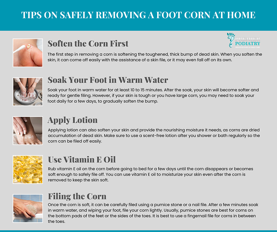 How to Safely Remove a Foot Corn at Home