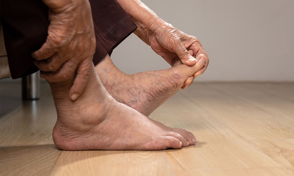 What Is Plantar Fasciitis and How to Know if I Have It?
